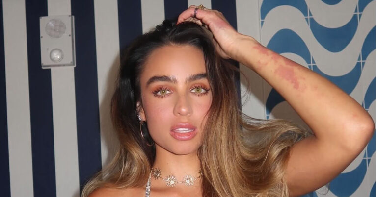 i sommer ray anastatonei to diadiktyo me tin tel