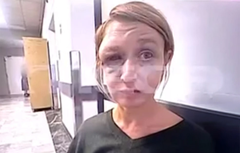 Σοκ στο Κορωπί: Η 40χρονη Λιθουανή που ξυλοκοπήθηκε μιλά για πρώτη φορά – «Ήταν σχέση αγάπης» 3 AGNES2