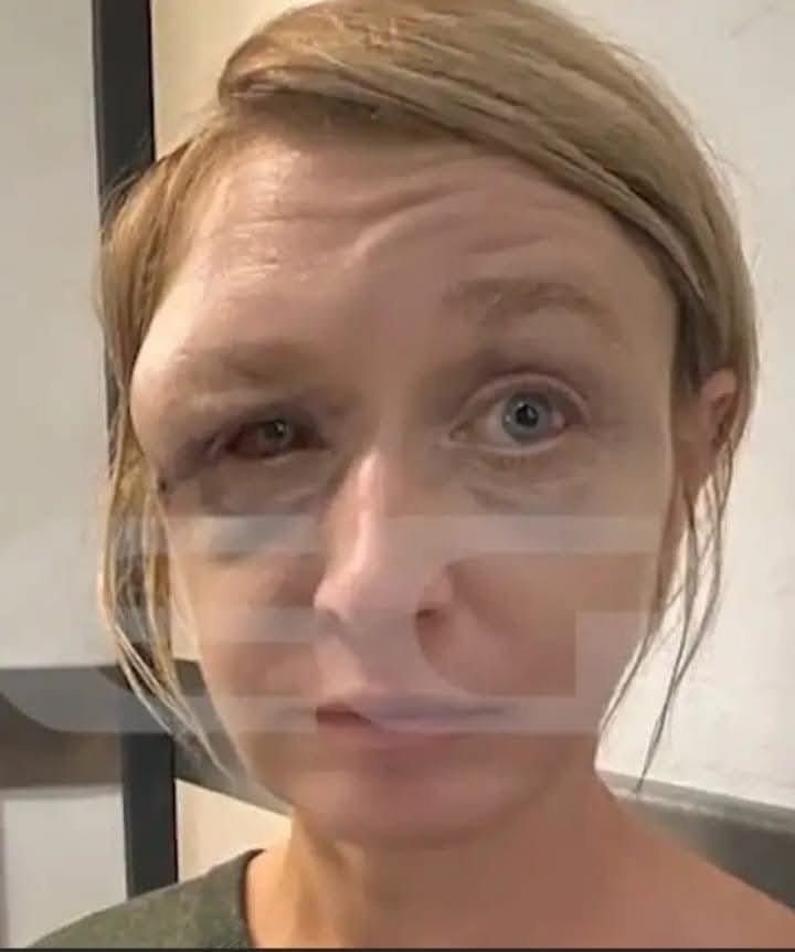 Κακοποίηση στο Κορωπί: Η 40χρονη Λιθουανή που ξυλοκοπήθηκε διεκδικεί την επιμέλεια των παιδιών της 2 Κακοποίηση στο Κορωπί