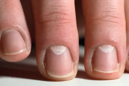 Κοντινή λήψη νυχιού με ορατό lunula