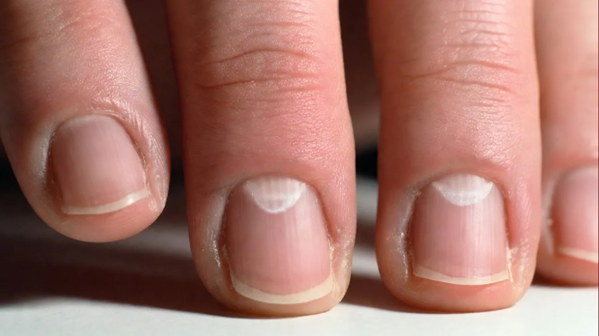 Κοντινή λήψη νυχιού με ορατό lunula