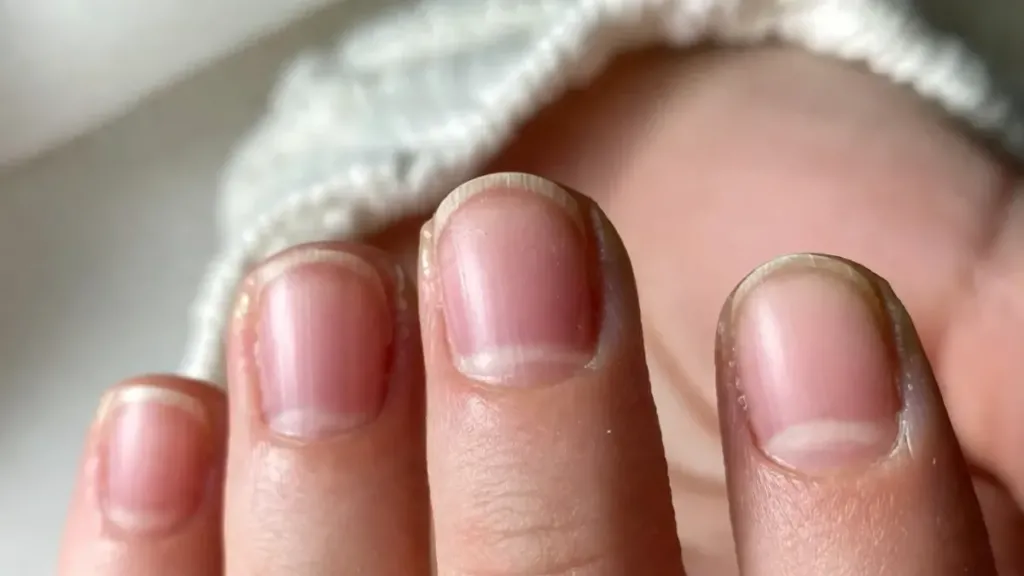 Το λευκό σημάδι στη βάση του νυχιού: Γιατί δεν πρέπει να το αγνοείς 2 νύχια